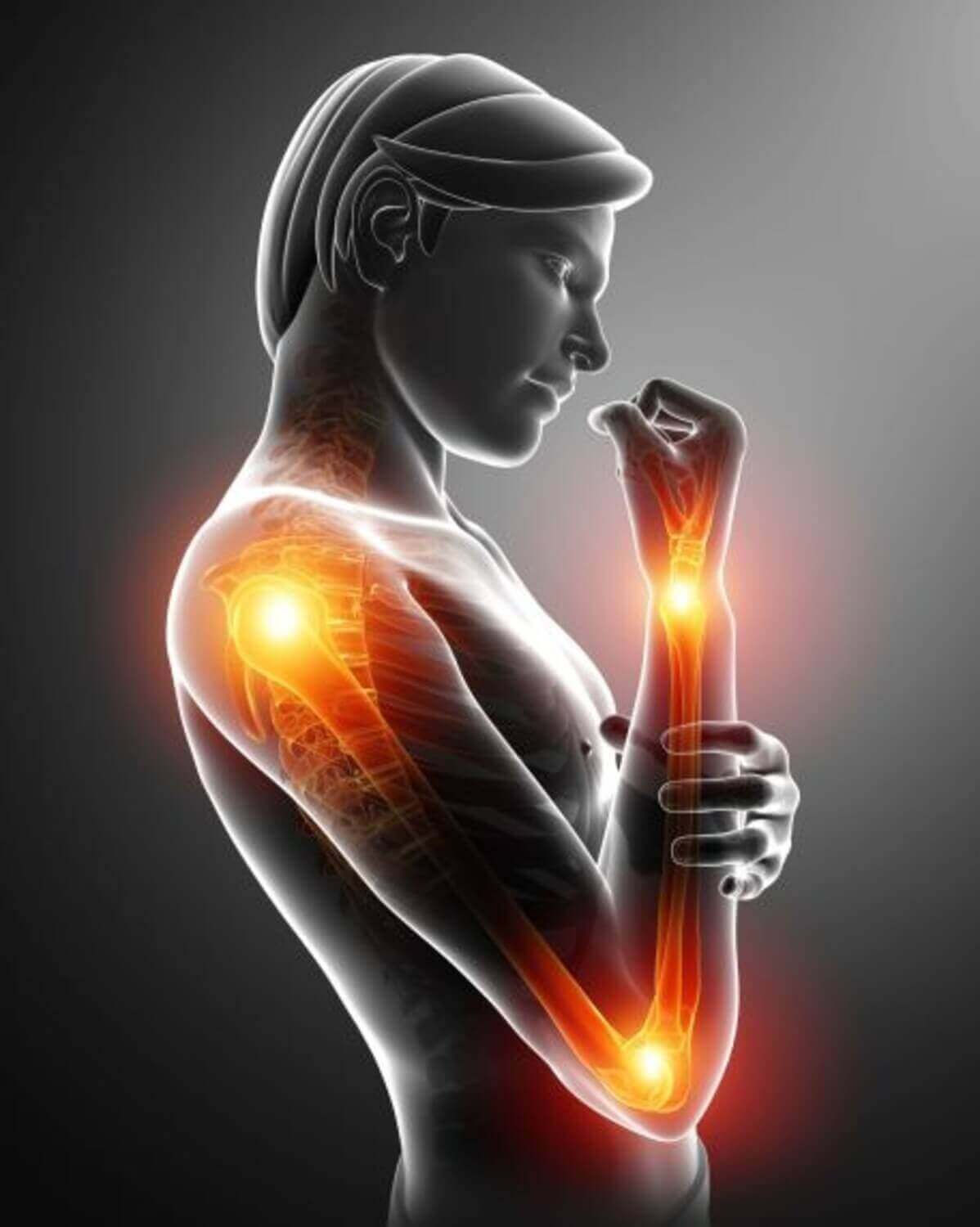 What Does Having A Warm Joint Mean?