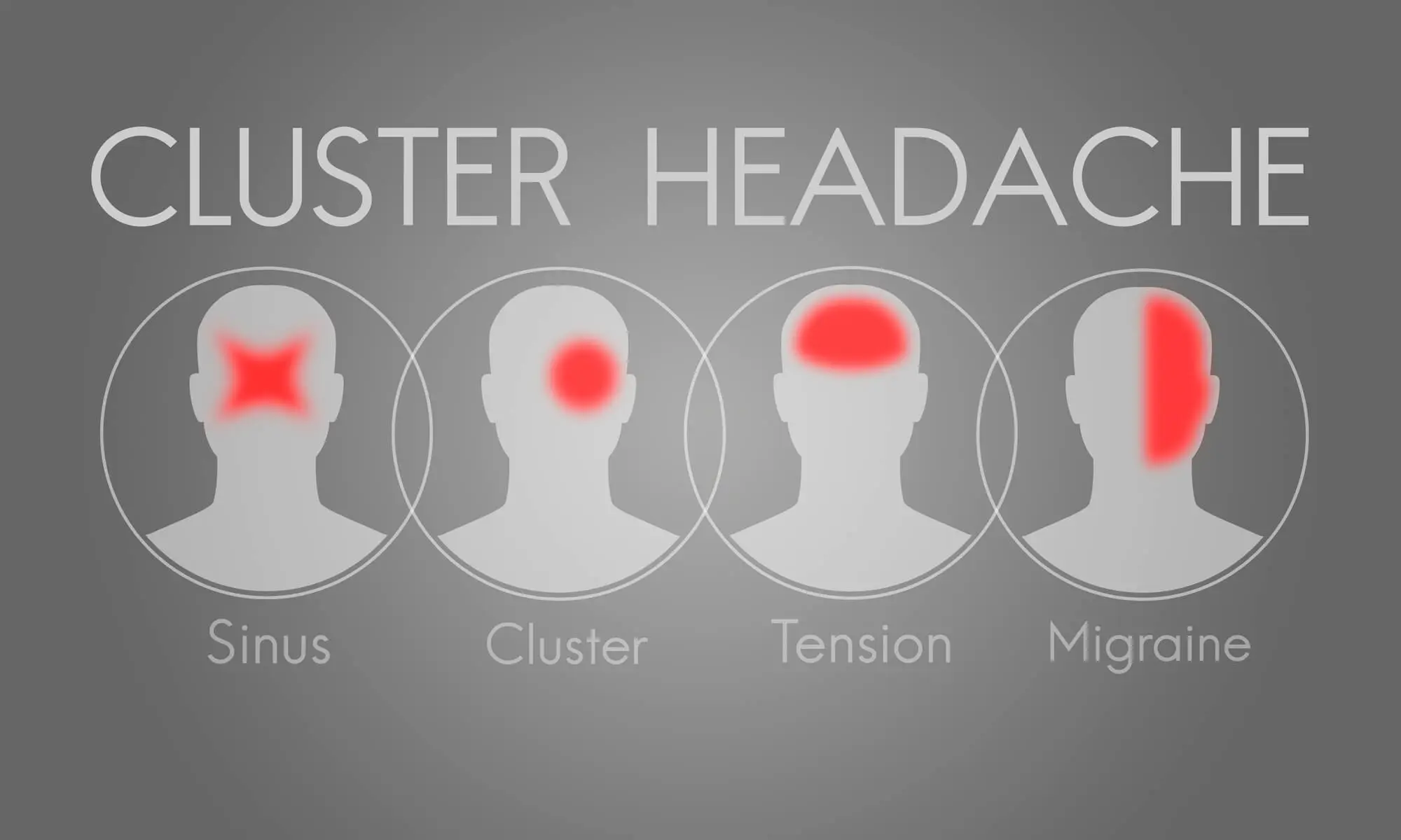 cluster headaches affected areas vs sinus, tension and migraine headaches