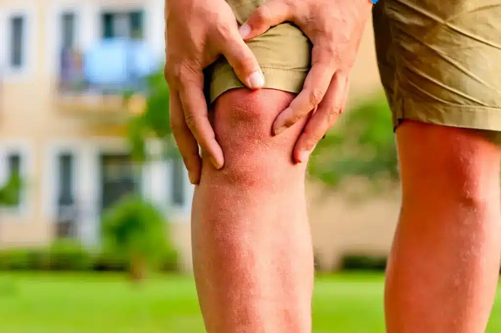 Relatyv - Osteoporosis Vs. Arthritis: What To Know About These Conditions