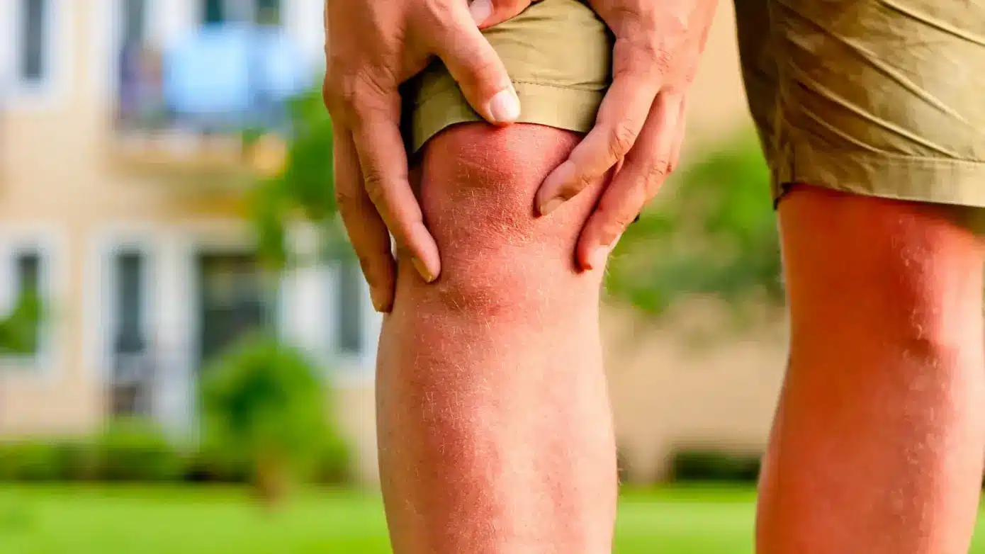 Relatyv - Osteoporosis Vs. Arthritis: What To Know About These Conditions