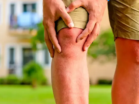 Relatyv - Osteoporosis Vs. Arthritis: What To Know About These Conditions