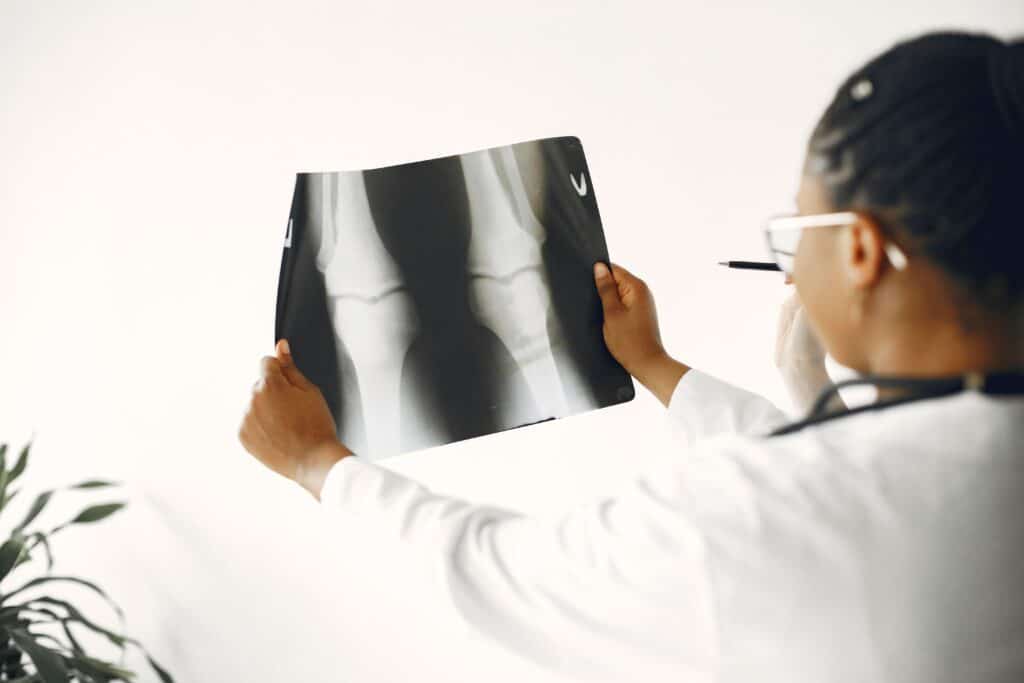 Relatyv - Can Osteoporosis be Reversed?