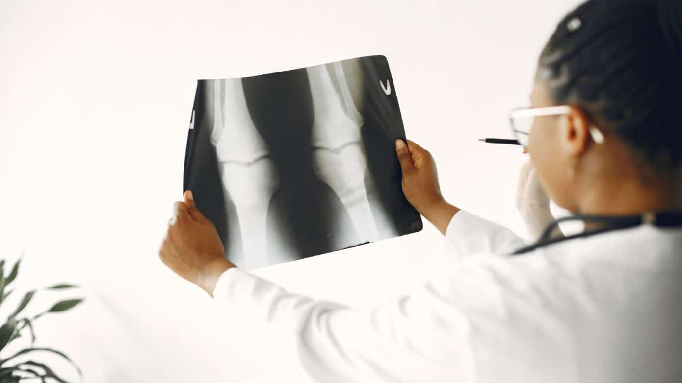 Relatyv - Can Osteoporosis be Reversed?