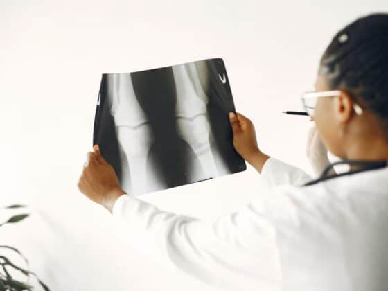 Relatyv - Can Osteoporosis be Reversed?