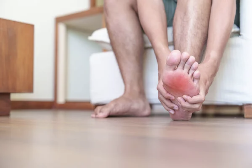 Relatyv - Does Plantar Fasciitis Cause Swelling?