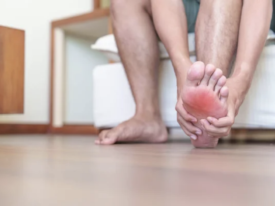 Relatyv - Does Plantar Fasciitis Cause Swelling?