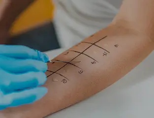 allergy testing