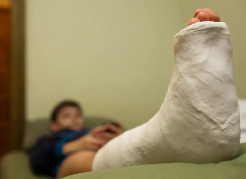Relatyv - Bone Fracture