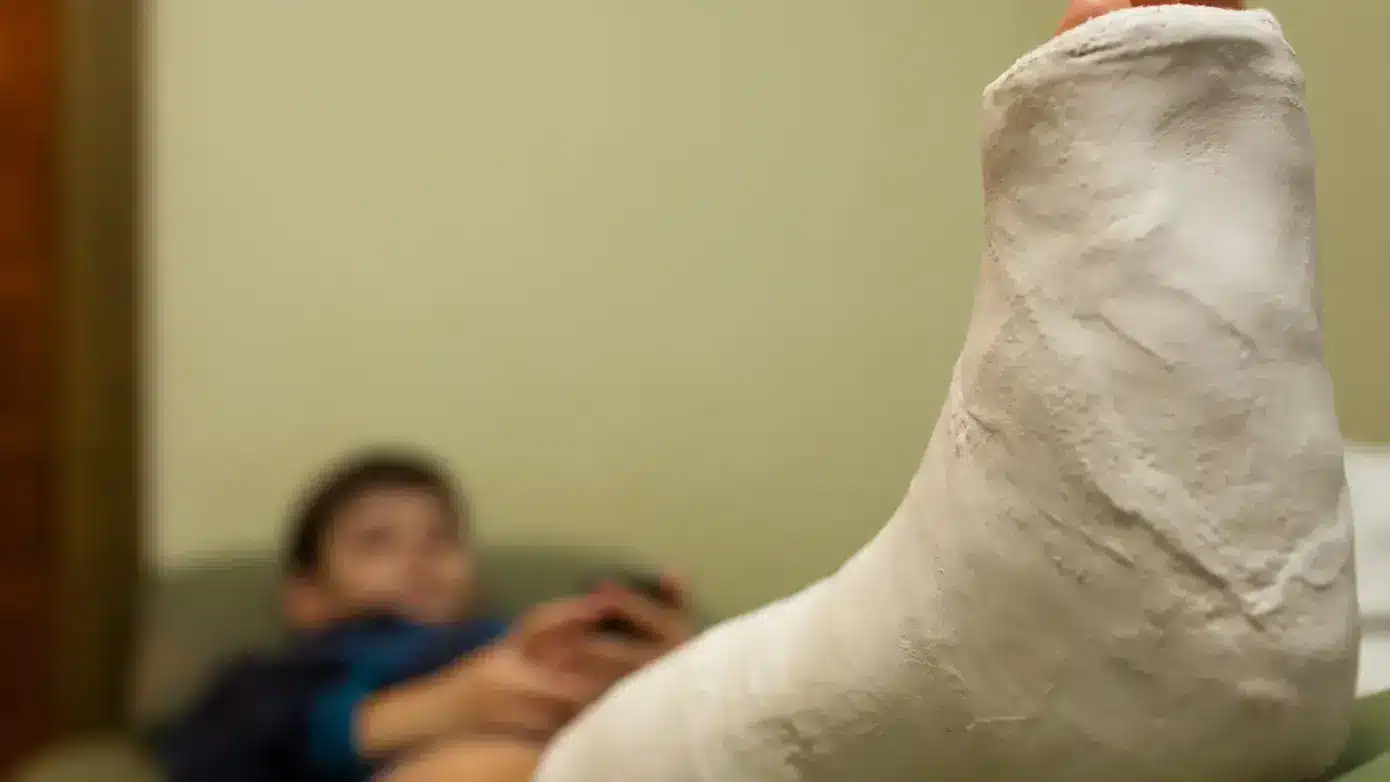 Relatyv - Bone Fracture