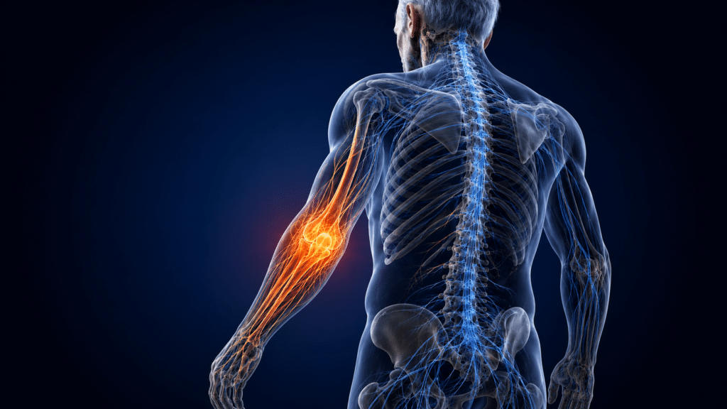 Relatyv Electroanalgesia for Chronic Pain