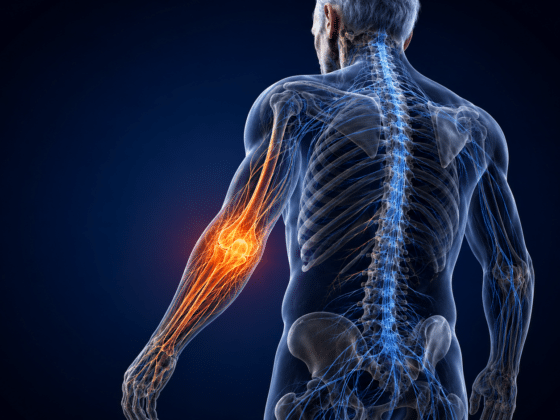 Relatyv Electroanalgesia for Chronic Pain