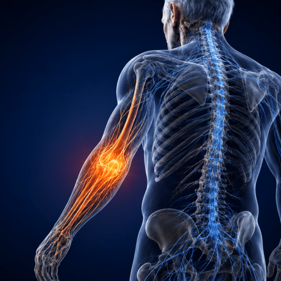 Relatyv Electroanalgesia for Chronic Pain