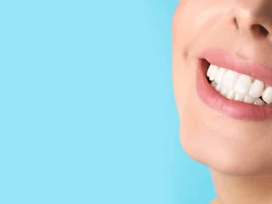 Relatyv - Malocclusion