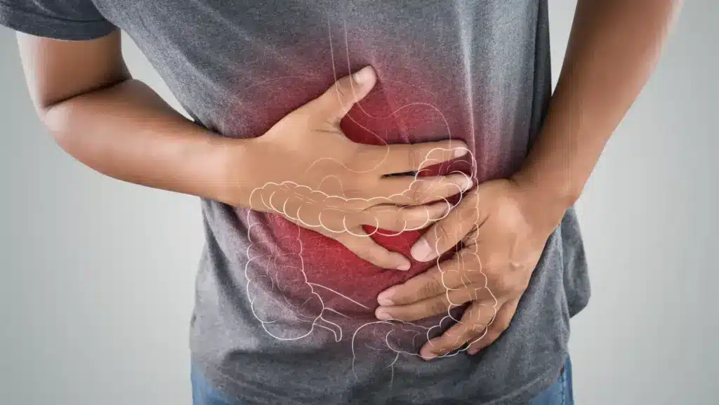 Relatyv - Ulcerative Colitis