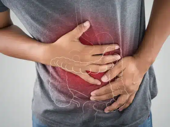 Relatyv - Ulcerative Colitis